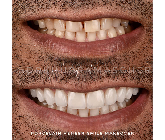 Smile gallery