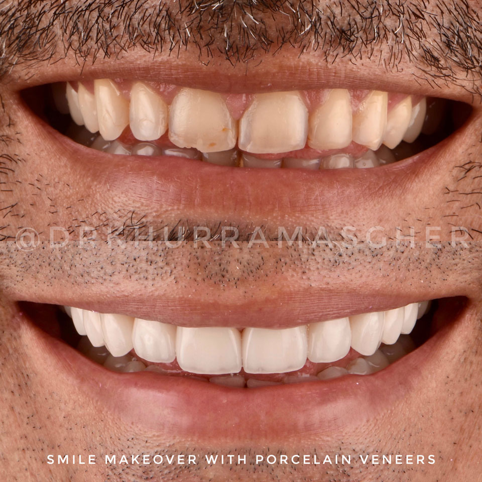 Smile gallery