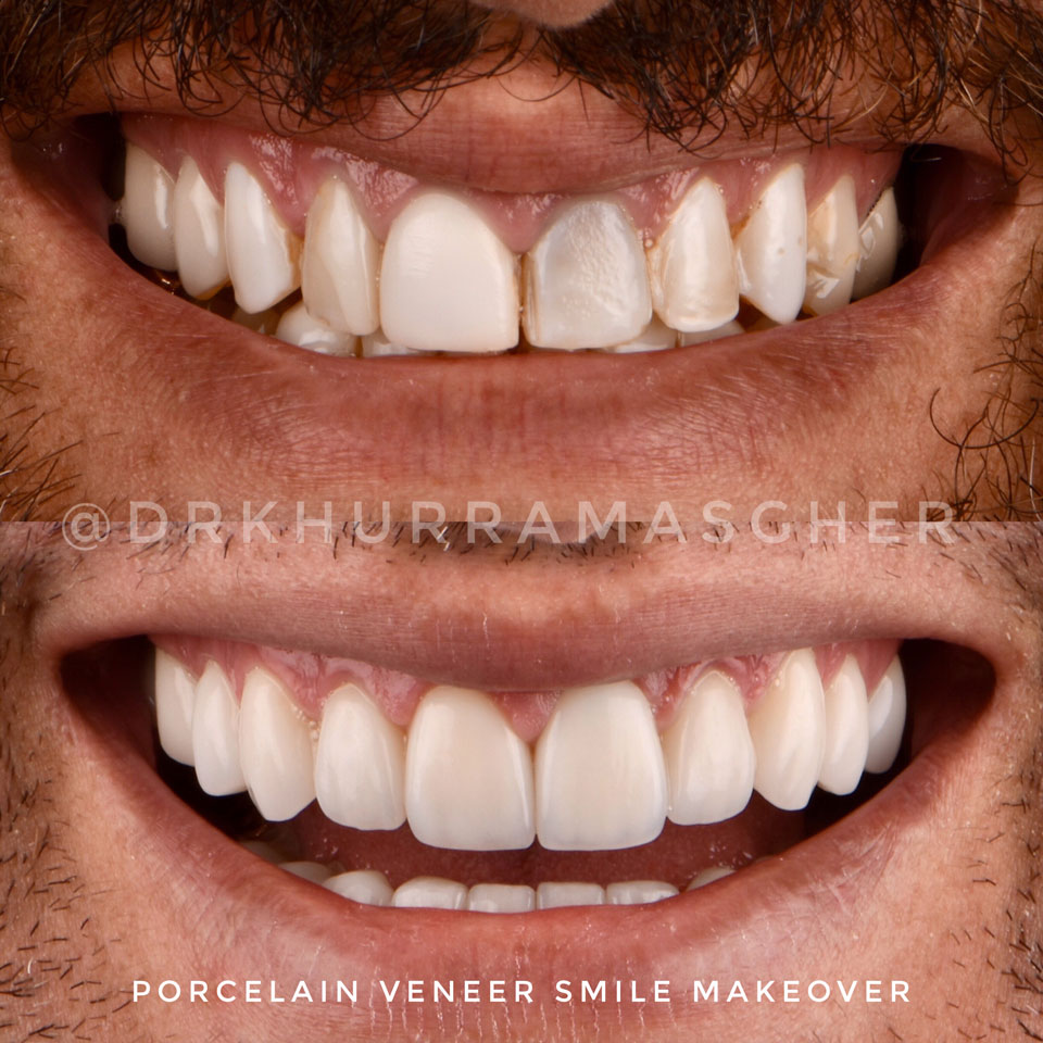 Smile gallery