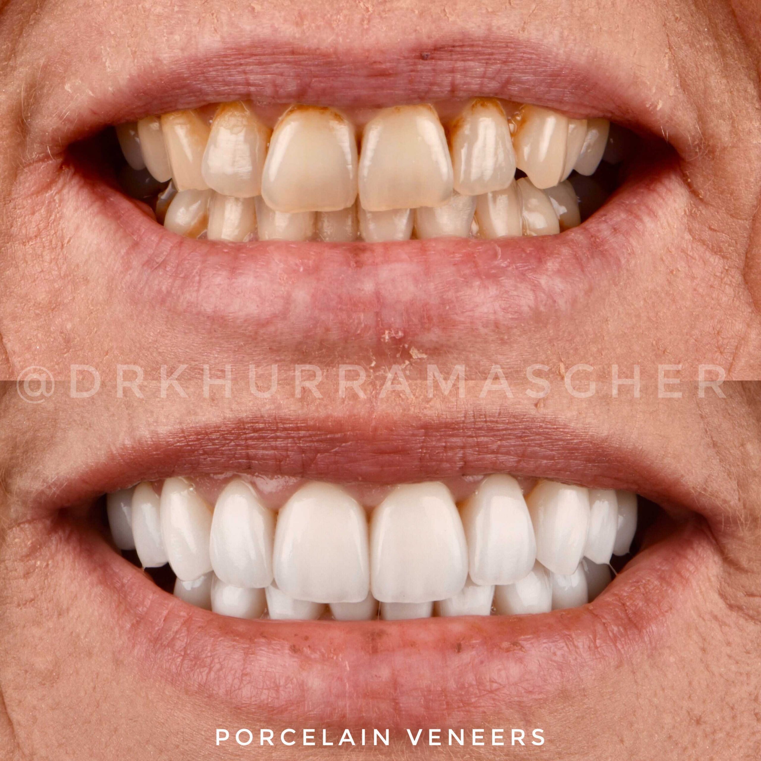 Smile gallery