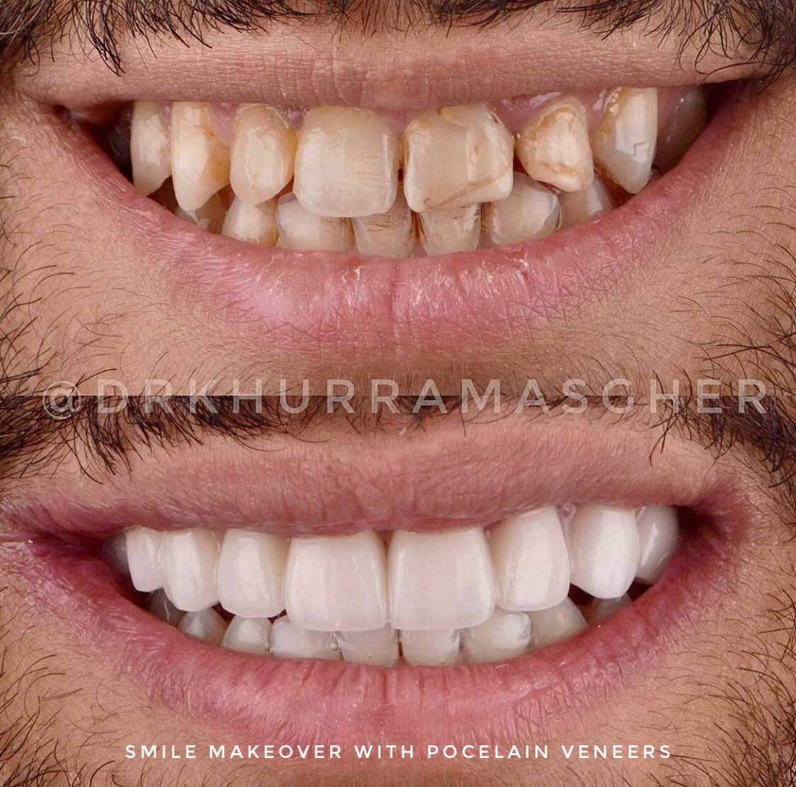 Smile gallery