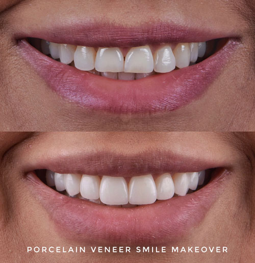 Smile-Gallery