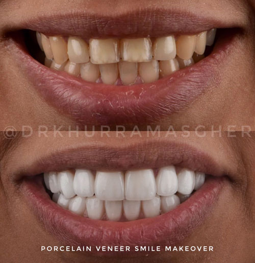 Smile-Gallery
