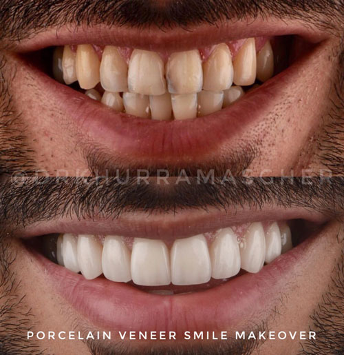 Smile-Gallery