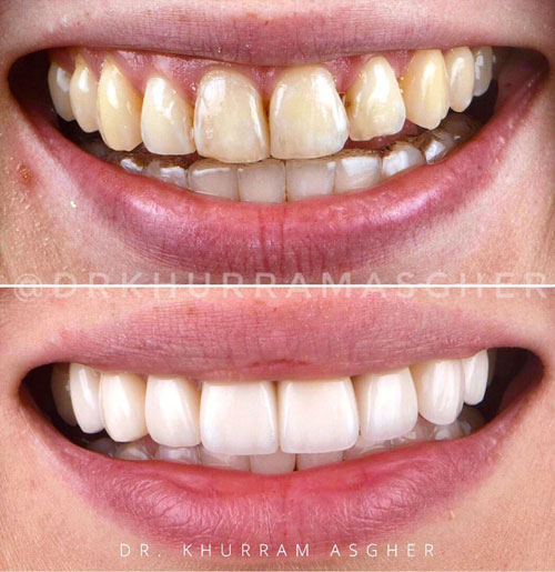 Smile-Gallery