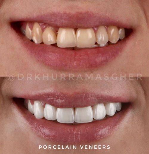 Smile-Gallery