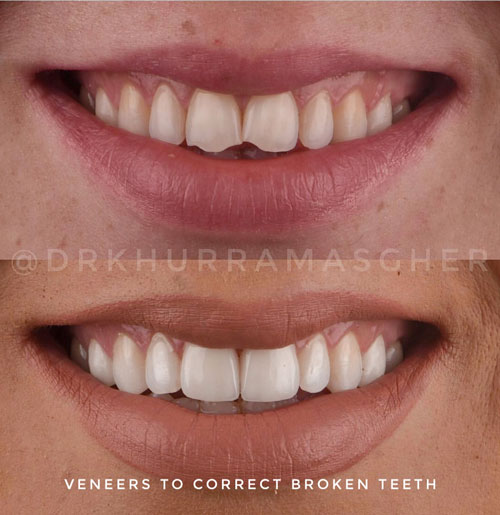 Smile-Gallery
