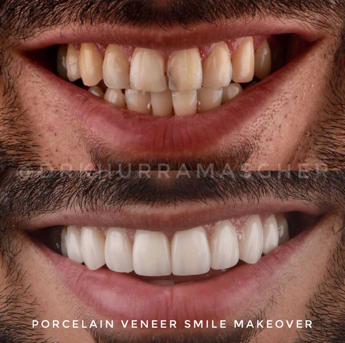 Smile-Gallery