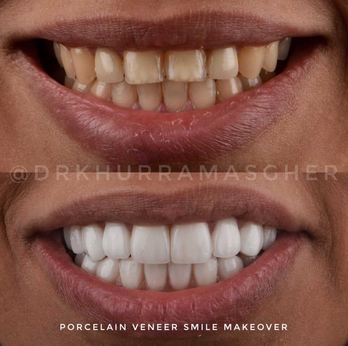 Smile-Gallery