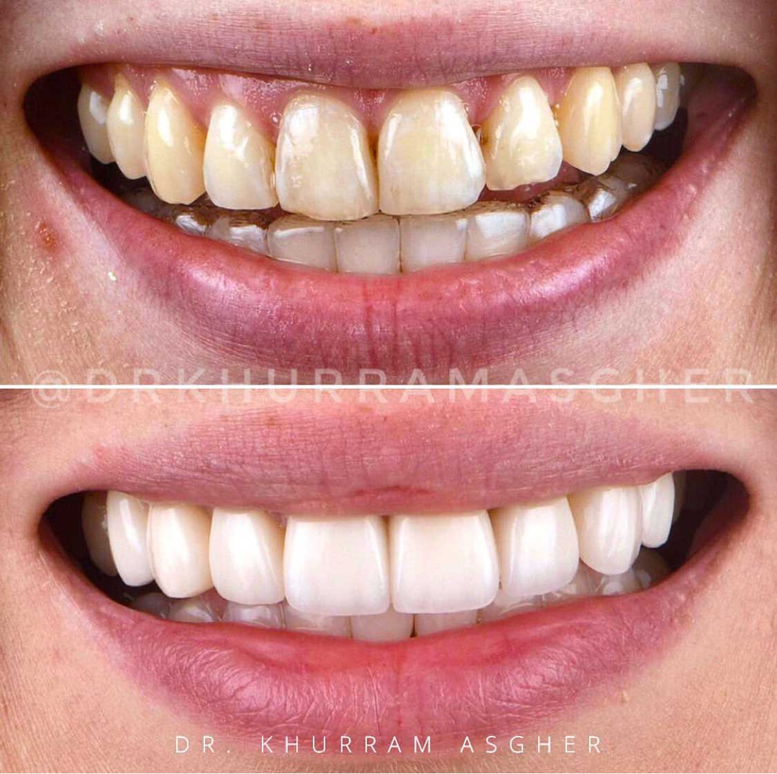 Smile-Gallery