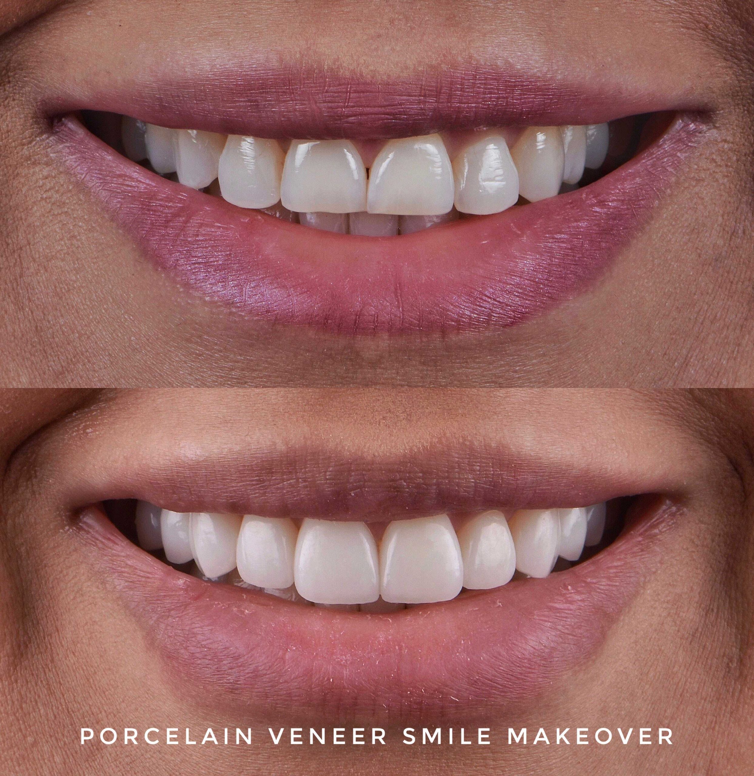 Smile-Gallery