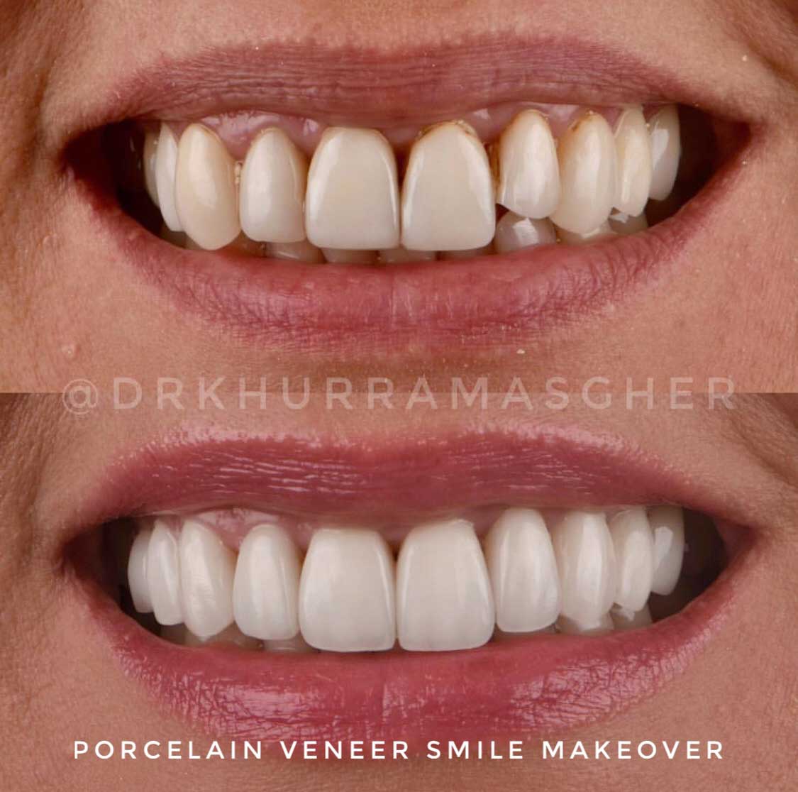 Smile-Gallery