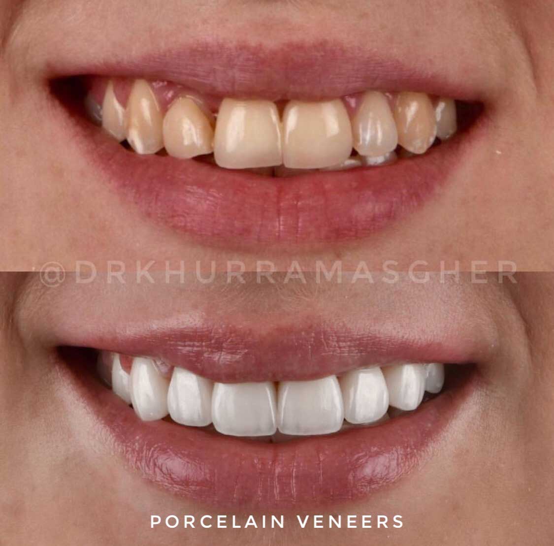 Smile-Gallery